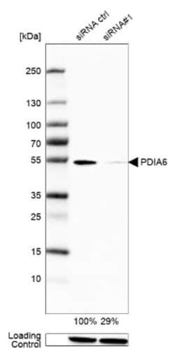 PDIA6 Antibody, Novus Biologicals 25 &mu;L, Unlabeled:Antibodies, Polyclonal